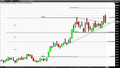 The Big Picture; Gold has Been in a Bullish Trend Since December 2015